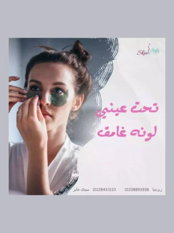 العناية بالهالات السوداء