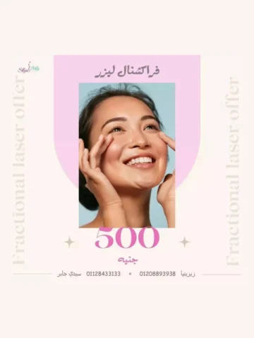 عرض الفراكشنال ليزر