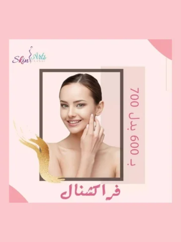عرض الفراكشنال ٦٠٠ج